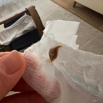 Molfix Bebek Bezinde Yabancı Cisim Endişesi Ve Müşteri Hizmetlerine Ulaşamama