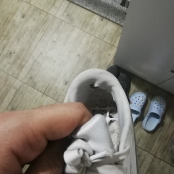 Üç Ayda Çatlayan Ayakkabı Nedeniyle Yaşadığım Mağduriyet Ve İade Talebim