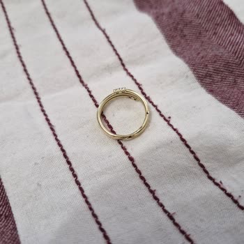 Alyansım Parlatma Sonrası Hasar Gördü, Atasay'dan Çözüm Bekliyorum