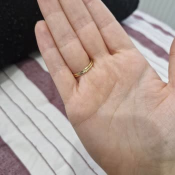 Alyansım Parlatma Sonrası Hasar Gördü, Atasay'dan Çözüm Bekliyorum