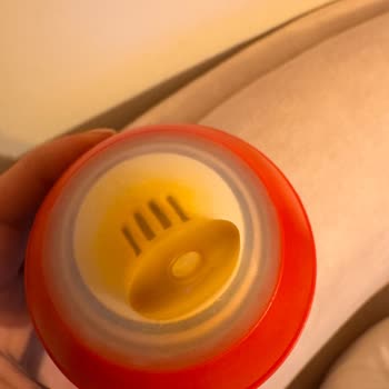 Kısa Sürede Sararan Philips Avent Biberon Başlığı Hayal Kırıklığı Yaşattı