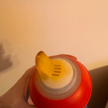 Kısa Sürede Sararan Philips Avent Biberon Başlığı Hayal Kırıklığı Yaşattı