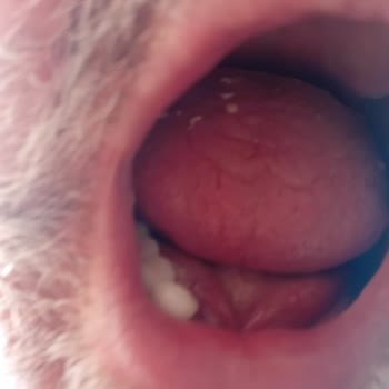 Mucize Diş Sağlığı Polikliniği Planlanan 16 İmplanttan Sadece 7'si Tuttu