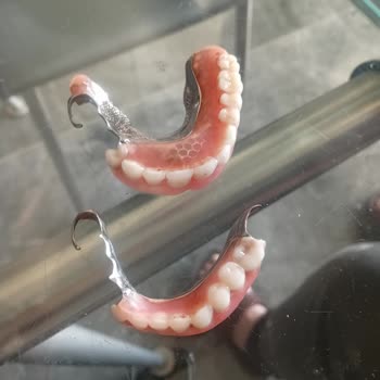 Mucize Diş Sağlığı Polikliniği Planlanan 16 İmplanttan Sadece 7'si Tuttu