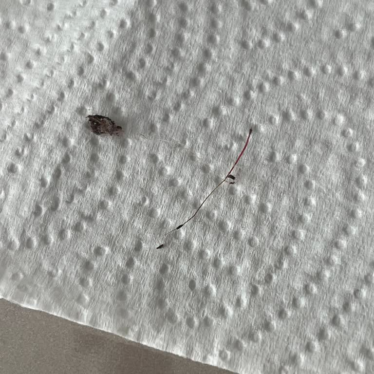 Piyale Toz Kakao Ürününde Yabancı Madde: Gıda Güvenliği Konusunda Endişe