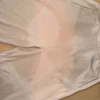 Dr. Beckmann Leke Canavarı Pantolonumda Kalıcı Hasara Yol Açtı