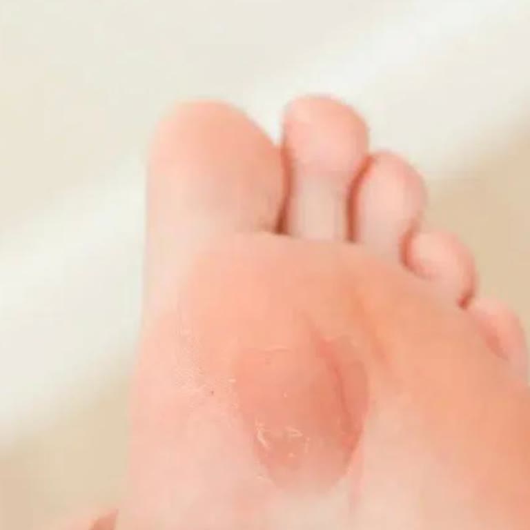 FLO'dan Alınan Ayakkabı Ayağımı Yaraladı, Değişim Talebim Reddedildi