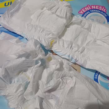 Molfix Bebek Bezinde Üretim Hatası Ve Güven Sorunu