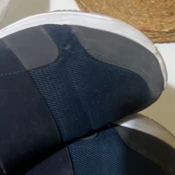 Üçüncü Giyişte Patlayan Ayakkabı Ve FLO'nun İlgisizliği