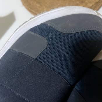 Üçüncü Giyişte Patlayan Ayakkabı Ve FLO'nun İlgisizliği