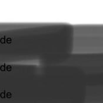 Anlaşma Dışında Ekstra Ücret Ve Kart Komisyonu Alınması Nedeniyle Mağduriyet