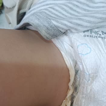 Molfix 5 Numara Bebek Bezi Sızdırıyor Ve Oğlumun Konforunu Olumsuz Etkiliyor