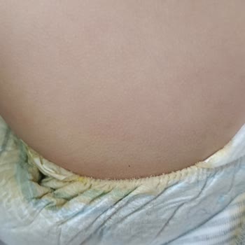 Molfix 5 Numara Bebek Bezi Sızdırıyor Ve Oğlumun Konforunu Olumsuz Etkiliyor