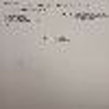 Skechers Ayakkabının Kısa Sürede Dikiş Atması Ve Garanti Talebimin Reddedilmesi