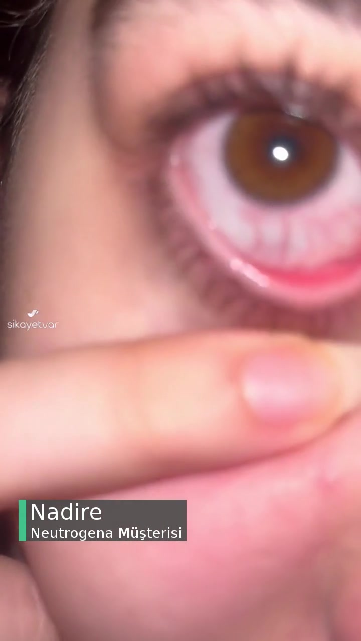 Neutrogena Micellar Su Gözümde Alerji Yaptı Görmemde Bulanıklık Yaşıyorum! videonun kapak resmi