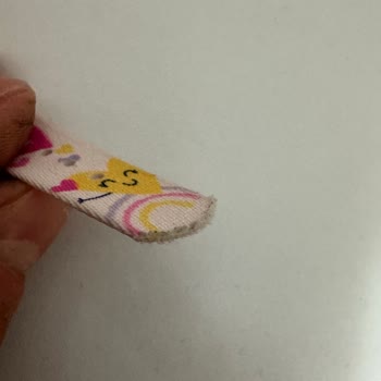 Swatch Saatte Kısa Sürede Oluşan Deformasyon Ve Çözüm Beklentisi