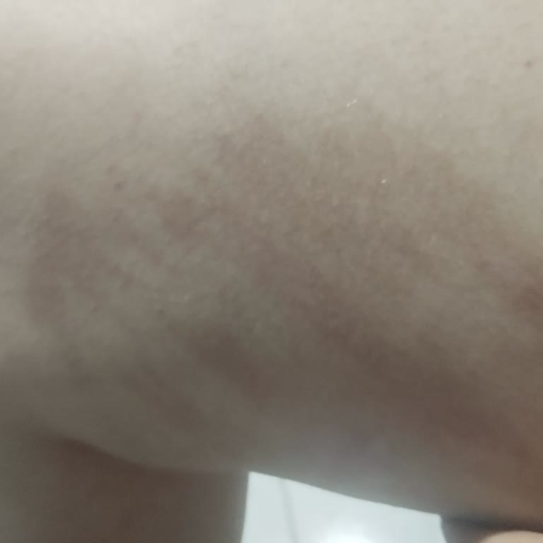 Fakir Püre/Buhar Makinesinde Güvenlik Sorunu Ve İlgisiz Müşteri Hizmeti