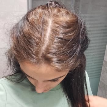 Yanlış Saç Boyası Nedeniyle Mağduriyet Yaşadım