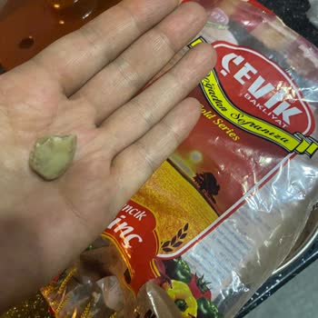 Çevik Bakliyat Pirinçte Hijyen Sorunu Ve Sağlık Riski: Acil Açıklama Ve Telafi Talebi!