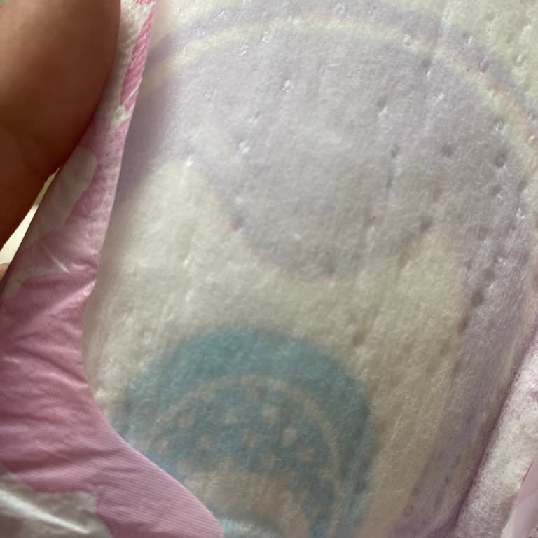 Getir'den Aldığım Orkid Platinum Pedde Kalite Sorunu Ve Alerjik Reaksiyon