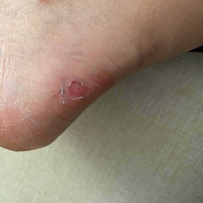 Greyder Botta Boya Akması Ve Rahatsızlık Sorunu, İlgisiz Mağaza Yaklaşımı