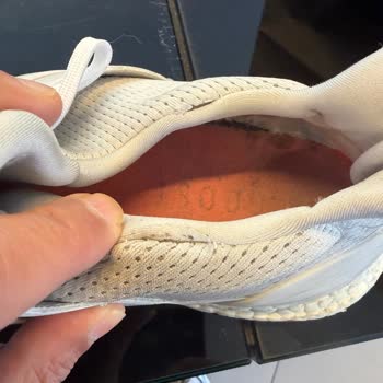 Adidas Ayakkabıda Açılma Sorunu Ve İlgisiz Müşteri Hizmeti