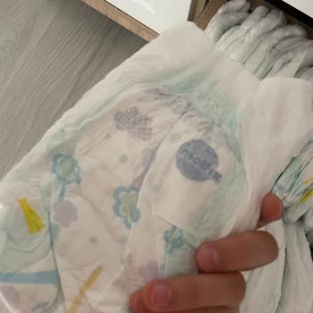 Molfix Külot Bezde Sızdırma Ve Kötü Koku Sorunu Yaşıyorum