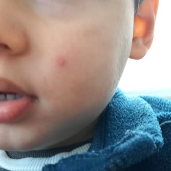 Bebek Losyonunda Koku Ve Cilt Reaksiyonu, Eczaneden Çözüm Alamama Hayal Kırıklığı