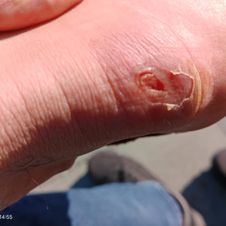 Dockers Bot Ayağımı Yaraladı, Çözüm Bekliyorum