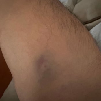 Kadıköy Medicana Acil Servisinde Dikkatsiz Uygulamalar, Yetersiz Bilgilendirme Ve Haksız Ücretlendirme Sonucu Mağduriyet