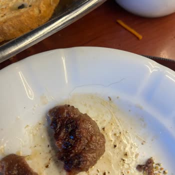 Restoranda Köftenin İçinden Çıkan Kıl Nedeniyle Yaşadığım Hijyen Sorunu