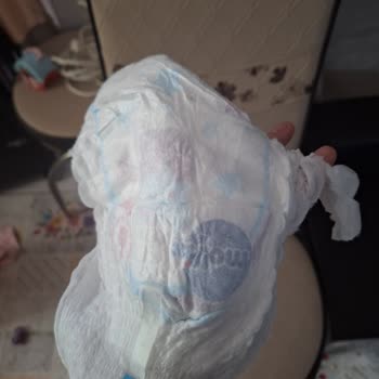 Molfix Külot Bezde Yırtıklar Hijyen Ve Güven Sorununa Yol Açtı