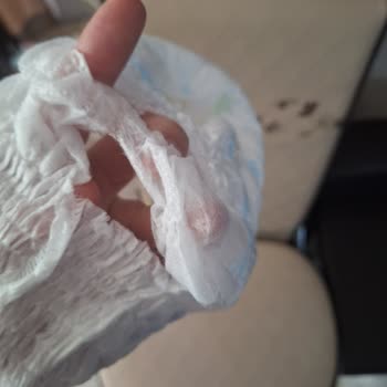 Molfix Külot Bezde Yırtıklar Hijyen Ve Güven Sorununa Yol Açtı