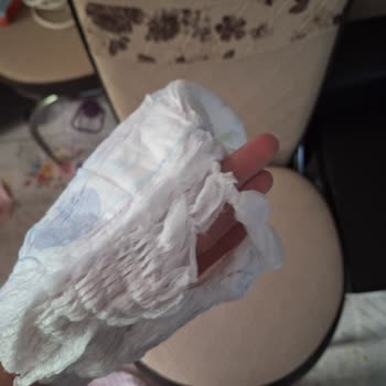 Molfix Külot Bezde Yırtıklar Hijyen Ve Güven Sorununa Yol Açtı