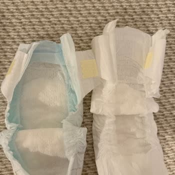 Prima Premium Care Bebek Bezinde Ülkelere Göre Kalite Farkı Ve Mağduriyet