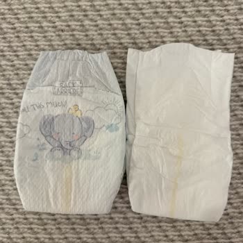 Prima Premium Care Bebek Bezinde Ülkelere Göre Kalite Farkı Ve Mağduriyet