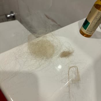 Salon Adonia Saç Açma İşlemi Sonrası Saçlarımda Ciddi Hasar ve Yetersiz Telafi Teklifi