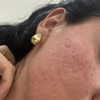 Yüksek Ücret Ve Acıya Rağmen Sonuçsuz Tedaviyle Mağdur Oldum