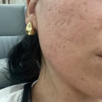 Yüksek Ücret Ve Acıya Rağmen Sonuçsuz Tedaviyle Mağdur Oldum