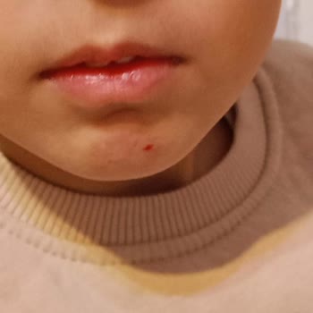 Kepez Belediyesi Kreşte Çocuklarımızın Güvenliği Tehlikede, Acil Çözüm Bekliyoruz