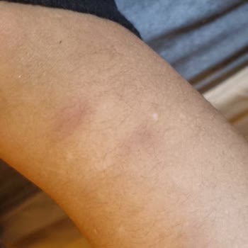 Kepez Belediyesi Kreşte Çocuklarımızın Güvenliği Tehlikede, Acil Çözüm Bekliyoruz