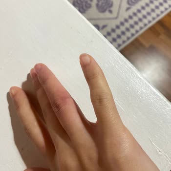 Yanlış Yüzük Ölçüsü Nedeniyle Mağduriyet Ve Ek Ücret Talebi