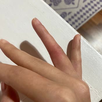 Yanlış Yüzük Ölçüsü Nedeniyle Mağduriyet Ve Ek Ücret Talebi