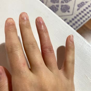 Yanlış Yüzük Ölçüsü Nedeniyle Mağduriyet Ve Ek Ücret Talebi