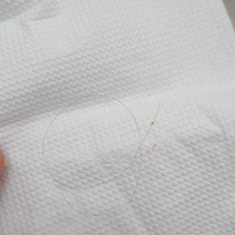 GetirYemek Siparişimde Saç Çıktı, Şikayetim Ciddiye Alınmadı