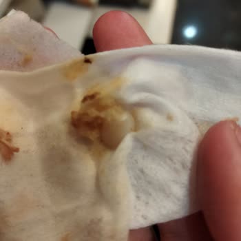 Öncü Döner Siparişimde Yabancı Madde Çıkması Ve Hijyen Sorunu