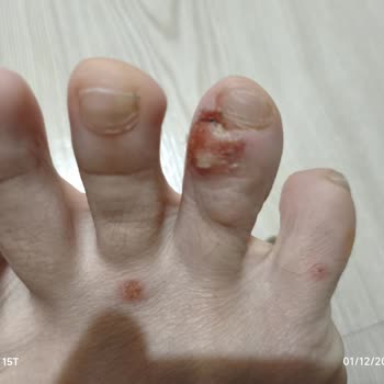 Tedi Mağazasından Alınan Ayak Maskesi Sağlık Sorunlarına Yol Açtı