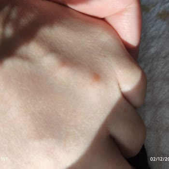 Tedi Mağazasından Alınan Ayak Maskesi Sağlık Sorunlarına Yol Açtı