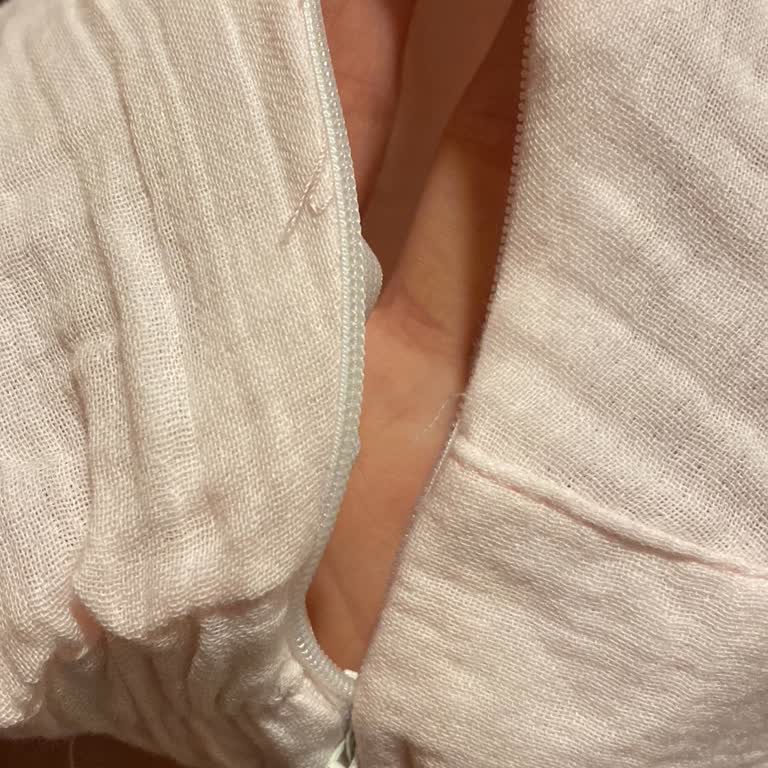 Bozuk Fermuarlı Ürün, Geciken Kargo Ve Kısmi İade Talebi