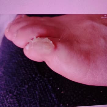 US Polo Ayakkabı Sağlığımı Olumsuz Etkiledi Mağaza Çözüm Sunmadı